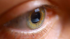 Hypnose Hypnose